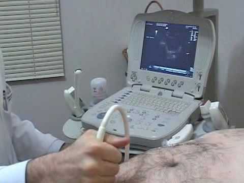 Ultrassonografia de Próstata - Clínica de urologia DK Urologistas